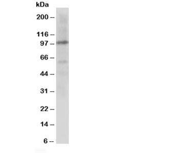 Western blot testing of Cullin 4B antibody and rat lung tissue lysate~