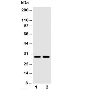 Western blot testing of SSX2 antibody and Lane 1: MCF-7; 2: HeLa cell lysate~