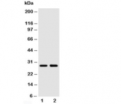 Western blot testing of SSX2 antibody and Lane 1:  MCF-7;  2: HeLa cell lysate