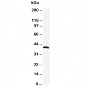 Western blot testing of CXCR4 antibody and HeLa cell lysate. Predicted molecular weight ~40 kDa but may be observed at higher molecular weights due to glycosylation.