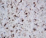 IHC-P: GFAP antibody testing of rat brain tissue. HIER: steam section in pH6 citrate buffer for 20 min and allow to cool prior to staining.
