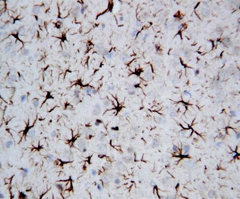 IHC-P: GFAP antibody testing of rat brain tissue