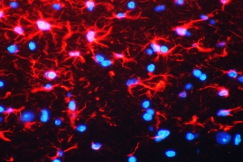 Immunofluorescent staining of mouse brain tissue with GFAP antibody at 1ug/ml. HIER: steam section in pH6 citrate buffer for 20 min and allow to cool prior to staining.
