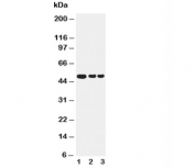 Western blot testing of GFAP antibody and Lane 1:  human U87 cell lysate;  2: mouse brain;  3: rat brain. Predicted molecular weight: ~50 kDa.
