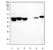 Western blot testing of 1) human MCF-7, 2) human Caco-2, 3) human HepG2, 4) human Jurkat, 5) rat RH35 and 6) mouse NIH 3T3 cell lysate with Cytokeratin 8 antibody. Predicted molecular weight ~54 kDa.