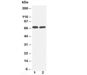 Western blot testing of TNFR2 antibody and Lane 1:  MM453;  2: Jurkat cell lysate.  Predicted molecular weight: 50 kDa (unmodified), 70-80 kDa (glycosylated).