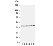 Western blot testing of Cyclin D1 antibody and Lane 1:  rat testis;  2: rat ovary;  3: rat brain;  4: HeLa;  5: MM231;  6: SW620 cell lysate. Predicted molecular weight: 32-36 kDa.