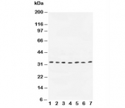 Western blot testing of Cyclin D1 antibody and Lane 1:  rat testis;  2: human placenta;  3: rat brain;  4: MCF-7;  5: COLO320;  6: SW620;  7: MM231. Predicted molecular weight: 32-36 kDa.