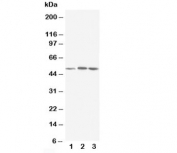 Western blot testing of NR1H3 antibody and Lane 1:  rat liver;  2: MCF-7;  3: HeLa cell lysate