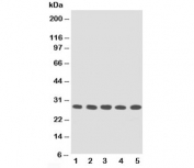 Western blot testing of TFPI2 antibody and human lysates from Lane 1:  MM453;  2: MM231;  3: HeLa;  4: HT1080;  5: Jurkat. Expected molecular weight: ~27 kDa (unmodified), 30-35 kDa (glycosylated).