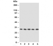 Western blot testing of TFPI2 antibody and human lysates from Lane 1:  MM453;  2: MM231;  3: HeLa;  4: HT1080;  5: Jurkat. Expected molecular weight: ~27 kDa (unmodified), 30-35 kDa (glycosylated).