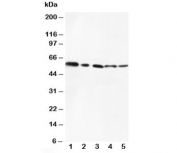 Western blot testing of AKT1/2 antibody and Lane 1:  MCF-7;  2: HeLa;  3: MM453;  4: HT1080;  5: COLO320 cell lysate. Predicted molecular weight: ~56kDa.