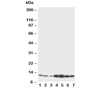 Western blot testing of S100 beta antibody and Lane 1: rat brain; 2: rat brain; 3: MCF-7; 4: HeLa; 5: SMMC-7721; 6: Jurkat; 7: COLO320 cell lysate