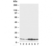 Western blot testing of S100 beta antibody and Lane 1:  rat brain;  2: rat brain;  3: MCF-7;  4: HeLa;  5: SMMC-7721;  6: Jurkat;  7: COLO320 cell lysate. Predicted/observed molecular weight: ~11kDa.