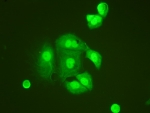 IF/ICC testing of HeLa cells