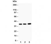 Western blot testing of TNFAIP1 antibody and Lane 1:  rat thymus;  2: HeLa;  3: COLO320;  Predicted size: 36KD;  Observed size: 36KD