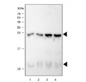 Western blot testing of 1) rat heart, 2) rat heart, 3) mouse heart and 4) mouse heart tissue lysate with Phospholamban antibody.  Predicted molecular weight: 6/12/18/24 kDa (monomer/dimer/oligomers).