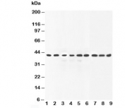 Western blot testing of ERK2 antibody and Lane 1:   human placenta;  2:  rat liver;  3:  rat brain;  4:  rat thymus;  5:  HeLa;  6:  SMMC-7721;  7:  COLO320;  8:  MM231;  9:  CEM