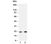 Western blot testing of PUMA antibody and Lane 1:  HeLa;  2: rat kidney;  Predicted molecular weight: 21/14/10/26kDa (isoforms alpha/beta/delta/gamma).