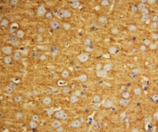 IHC-P: SNAP25 antibody testing of rat brain tissue