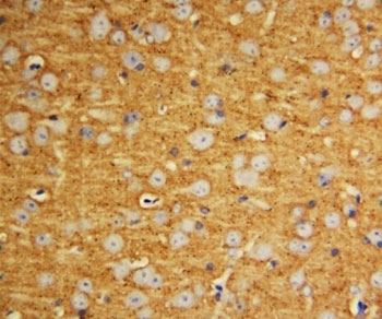 IHC-P: SNAP25 antibody testing of rat brain tissue
