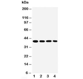 Western blot testing of MTCO1 antibody and Lane 1: SMMC-7721; 2: MCF-7; 3: Raji; 4: SW620 cell lysate