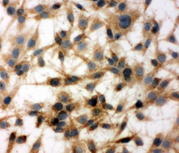 ICC testing of rat C6 cells