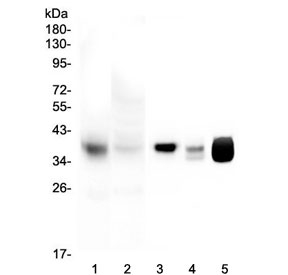 Western blot testing of 1) human HeLa mitochondrial enriched fraction (20ug/lane), 2) human HeLa whole cell lysate (20ug/lane), 3) human Caco-2 whole cell lysate (50ug/lane), 4) rat heart whole cell lysate and 5) mouse heart whole cell lysate with MTCO1 antibody. Predicted molecular weight ~57 kDa, also observed at ~40 kDa (ref. 1).