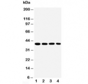Western blot testing of human 1) SMMC-7721, 2) MCF-7, 3) Raji and 4) SW620 cell lysate with MTCO1 antibody. Predicted molecular weight ~57 kDa, also observed at ~40 kDa (ref. 1).