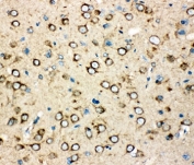 IHC-P: MTCO1 antibody testing of rat brain tissue.