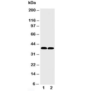 Western blot testing of MTCO1 antibody and Lane 1: rat heart; 2: mouse heart tissue lysate