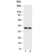 Western blot testing of MTCO1 antibody and Lane 1:  rat heart;  2: mouse heart tissue lysate. Predicted molecular weight ~57 kDa, also observed at ~40 kDa (ref. 1).
