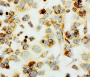 ICC testing of mouse HEPA1-6 cells with MTCO1 antibody.