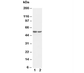 Western blot testing of c-Fos antibody and Lane 1: HT1080; 2: COLO320 cell lysate