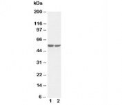 Western blot testing of c-Fos antibody and Lane 1:  HT1080;  2: COLO320 cell lysate. Expected molecular weight: ~40 kDa (unmodified), 53-68 kDa (phosphorylated).