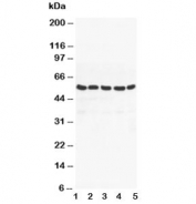 Western blot testing of PPAR gamma antibody and Lane 1:  MM453;  2: MM231;  3: HeLa;  4: Jurkat;  5: HT1080 cell lysate. Predicted molecular weight: 54-57 kDa.