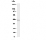 Western blot testing of NPHS2 antibody and rat kidney tissue lysate.  Predicted molecular weight ~42kDa.
