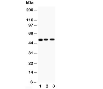 Western blot testing of CHRM2 antibody and Lane 1: rat brain; 2: mouse brain; 3: human U87; Predicted/observed size: 52KD~