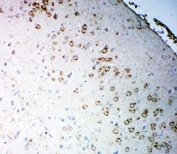 IHC-P: CHRM2 antibody testing of rat brain tissue