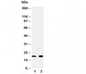 Western blot testing of Ly6AL antibody and Lane 1:  rat heart;  2: rat liver tissue lysate. Predicted molecular weight ~16 kDa.