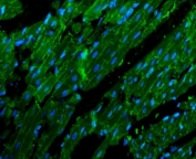 Immunofluorescent staining of FFPE rat heart tissue with N-Cadherin antibody (green) and DAPI nuclear stain (blue). HIER: steam section in pH8 EDTA for 20 min.
