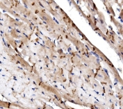 IHC staining of FFPE mouse heart tissue with N-Cadherin antibody. HIER: boil tissue sections in pH8 EDTA for 20 min and allow to cool before testing.