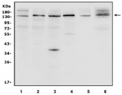 Western blot testing of 1) rat brain, 2) rat heart, 3) rat liver, 4) mouse heart, 5) mouse liver and 6) human SK-O-V3 cell lysate with N-Cadherin antibody. Predicted molecular weight ~100 kDa (unmodified), 125-140 kDa (modified).