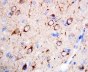 IHC-P: nNOS antibody testing of rat brain tissue