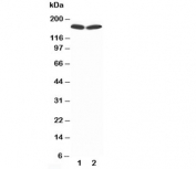 Western blot testing of nNOS antibody and Lane 1:  rat brain lysate;  2: human MCF-7 lysate;  Predicted molecular weight ~160 kDa.