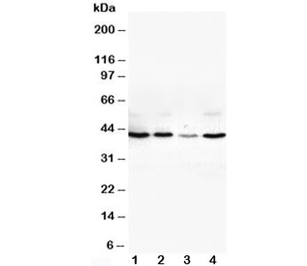 Western blot testing of VEGFD antibody and Lane 1: SW620; 2: COLO320; 3: 6T-CEM; 4: HT1080 cell lysate