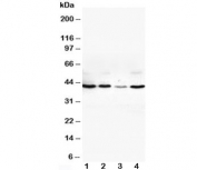 Western blot testing of VEGFD antibody and Lane 1:  SW620;  2: COLO320;  3: 6T-CEM;  4: HT1080 cell lysate. Expected molecular weight: 40-53 kDa (pro-form), ~21 kDa (mature/active form).