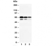 Western blot testing of CD34 antibody and Lane 1:  Recombinant human CD34 protein 10ng;  2: 5ng;  3: 2.5ng