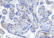 IHC-P: CD34 antibody testing of human placental tissue with CD34 antibody. HIER: boil tissue sections in pH8 EDTA for 20 min and allow to cool before testing.