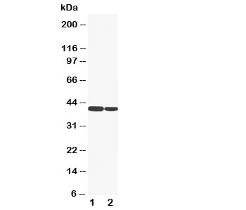 Western blot testing of Cytokeratin 19 antibody and Lane 1: HT1080; 2: COLO320 cell lysate